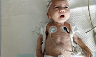 低烧不退警惕四种疾病 低烧不退警惕四种疾病